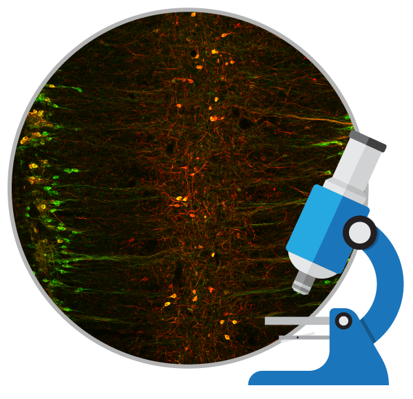 sca cell images Spinal cord