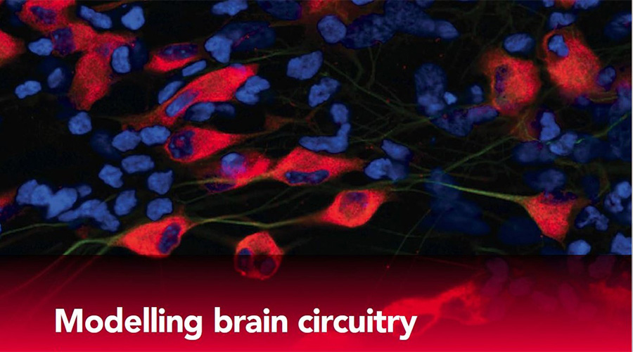 sca stories Modelling brain circuitry